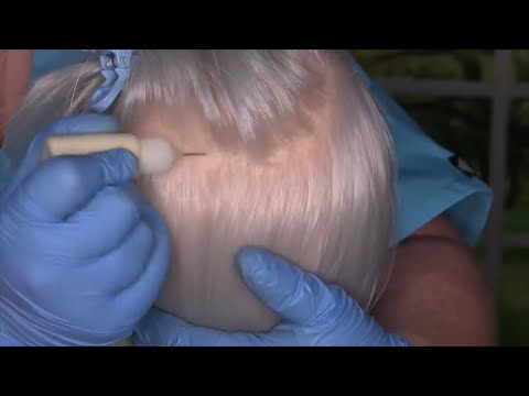 ASMR Dry Scalp Check and Treatment (Scalp Massage, Tweezers, Whispering) Medical Roleplay