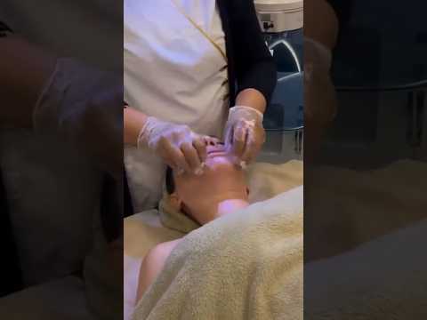 Masaje intraoral para aliviar bruxismo 👄 #shorts #massage #asmr