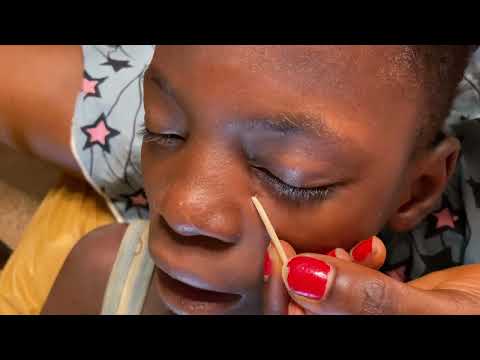 ASMR PICKING A LITTLE SOMETHING ON THE FACE WITH TOOLS AND BUBBLEGUM SOUNDS
