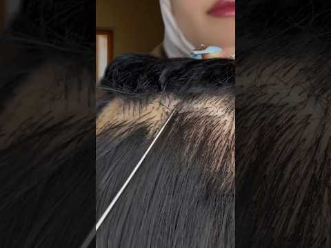 Scratching your Scalp 💆🏻‍♀️ #asmr #shorts #relax #asmrscratching