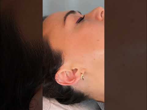 ASMR Ear Exam, Massage, Treatment 🩵 #asmr #asmrrealperson #asmrear #asmrmedical #asmrsounds