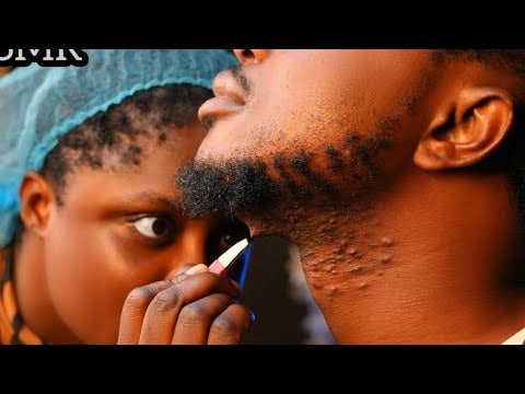 Sleep ASMR*Gentle full face nitpicking |Beard Trimming with Scissor✂️| Ingrown Hair pull Compilation