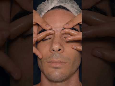 ASMR: Rimozione Acne e Punti Bianchi con Aspiratore! #shorts