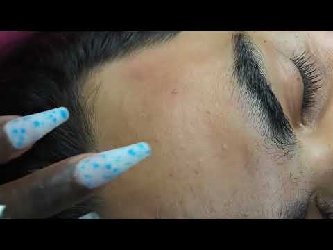 ASMR | Soft & Attentive Face Picking with tweezers