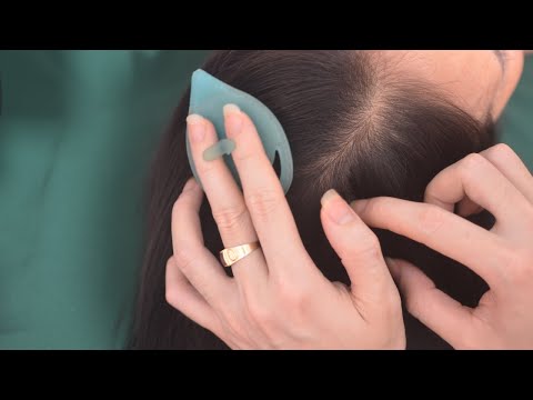 ASMR Relaxing Head Scratching, Fast Scratching Sounds, Hair Tingling For De-Stress