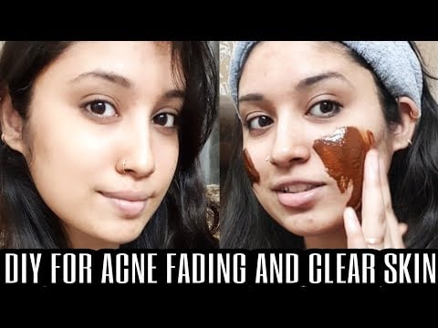 DIY TURMERIC FACE PACK FOR GROWLING, ACNE FREE AND CLEAR SKIN | HOME REMEDY | V STYLE