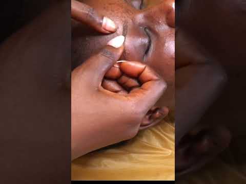 THE FLAWLESS FACE CLEANING #asmr #satisfying #nitpicking #pimplepopping