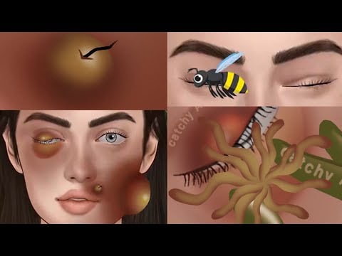 Bee sting treatment animation ASMR || Forest bee sting animated ASMR