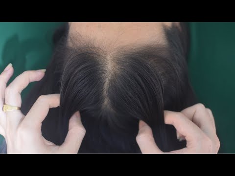 ASMR Hair Pulling & Head Scratching Massage, Tingling Hair Sounds For People Cure Insomnia