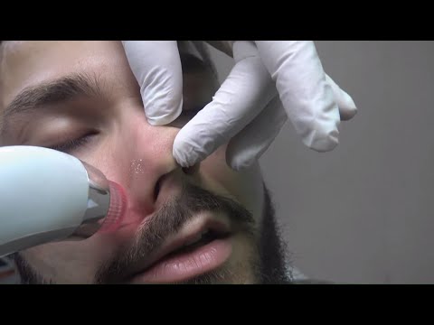 ASMR TURKISH BARBER = SKIN CARE = RAZOR BEARD SHAVE=EAR BURN=hair straightener and care= cilt bakımı