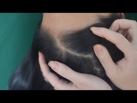 ASMR Real Person Scalp Scratching, No Talking Hair Parting With Tools, Sounds For Relieve Stress