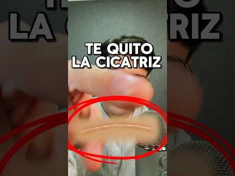 TE QUITO LA CICATRIZ #asmr #shorts #asmrvideo #comedia