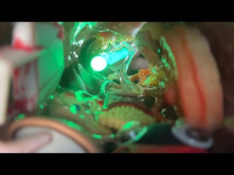 ASMR Ear Cleaning 👂🧼 But Your Ear Is Infected (tingly mouth sounds & up close visuals)