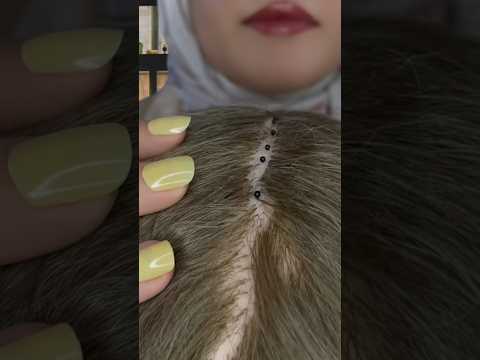 Scalp check (scratching) #asmr #satisfying #visualtingle #relax #asmrscratching #shorts