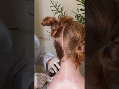Asmr scalp tingles #asmr #asmrsounds #asmrvideo #relax #relaxing #satisfying #hair #sleep #tingles