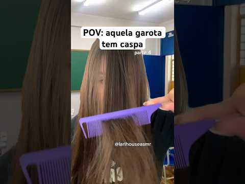 POV: aquela garota tem caspa #shorts #humor