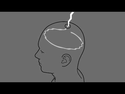 𝗔𝗦𝗠𝗥 팅글이 뇌로 들어간다면