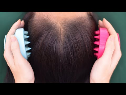 [ ASMR ] I Massage Your Scalp For Relieve Headache ( No Talking )