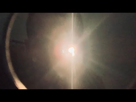 ASMR: Dark Room Retinoscopy UP CLOSE (roleplay) Bright light warning ⚠️