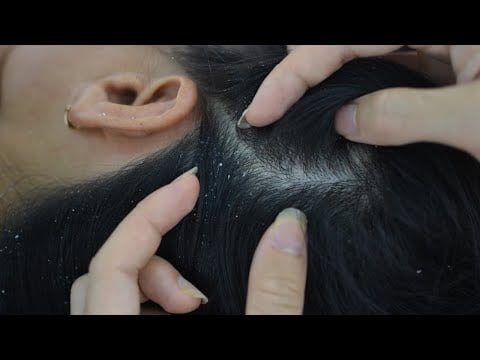 ASMR Scalp Scratching, Nape Scratching Aggressive For Realaxtion ( Asmr No Talking )