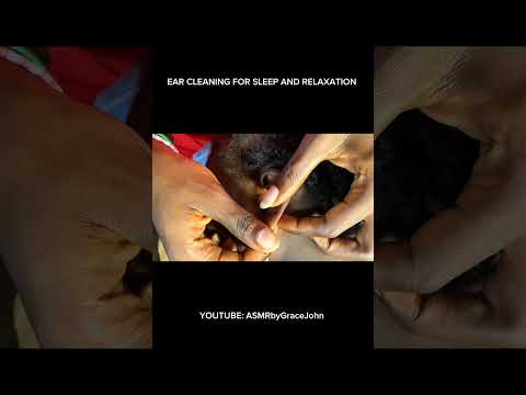 Deep ear cleaning and nitpicking very satisfying #relax #asmr