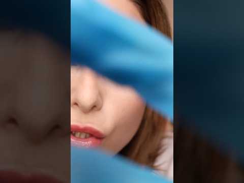 ASMR Dermatologist Mole Removal