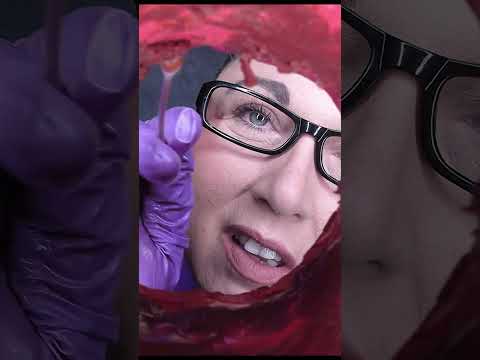 ASMR Ear Cleaning #shorts
