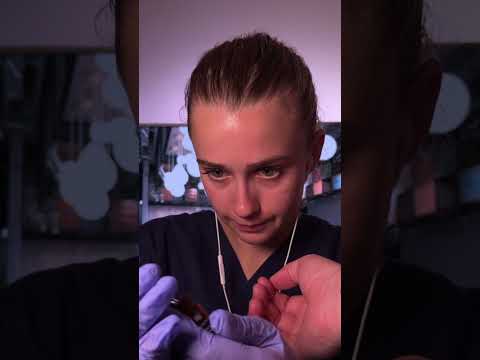 Test allergique sur le bras