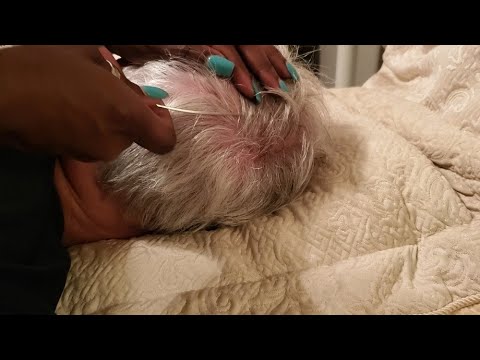 Scalp Check / Dandruff Check with Scalp Scratching Massage