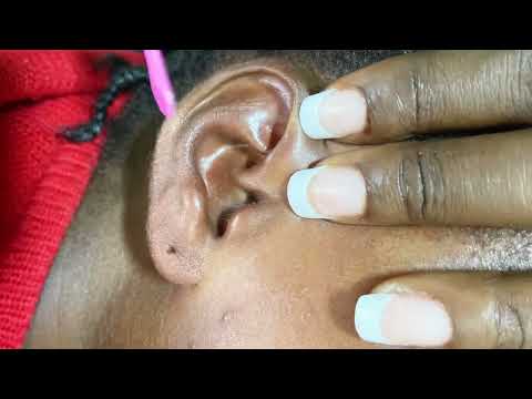 ASMR ✨ CORNROW, SCALP SCRATCHING & DEEP EAR PICKING & CLEANING 😴