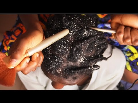 ASMR FAST AND AGGRESSIVE SCALP SCRATCHING WITH MULTIPLE TOOLS AND FAKE FLAKES REMOVAL😴😴