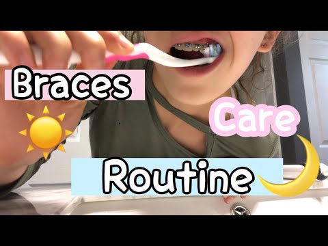 BRACES ROUTINE!!! + tips!!😁