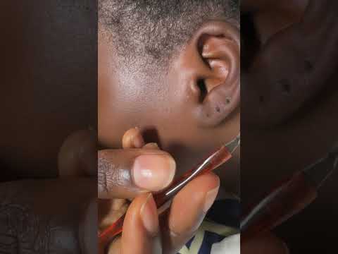 ASMR DEEP EAR CLEANING AND MASSAGE VERY INTENSE #asmrearcleaning