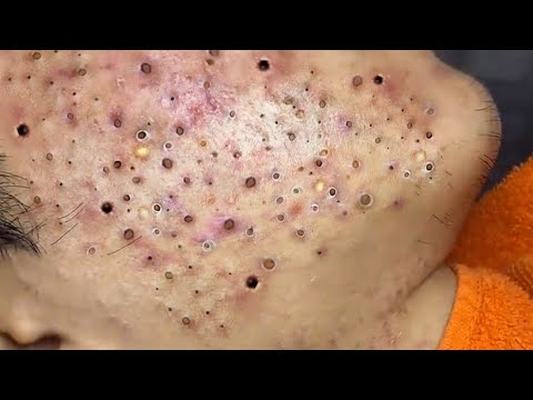 حلول طبيعية لبشرة صافية# 𝐒𝐤𝐢𝐧 𝐂𝐚𝐫𝐞 66892