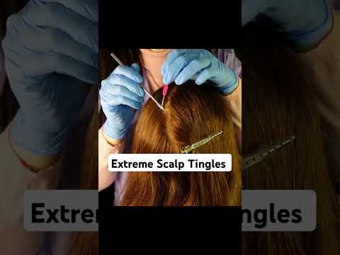 Extreme Scalp Tingles Alert ⚠️ #asmr