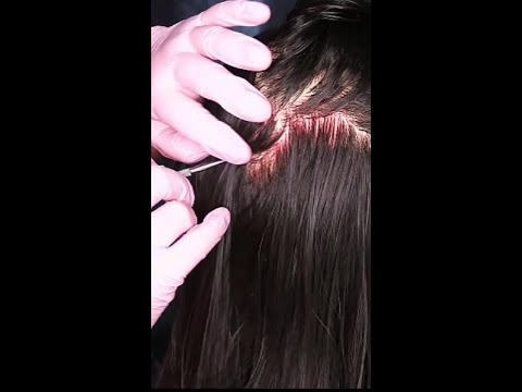 ASMR Scalp Check with Bad Results (NO TALKING) #shorts