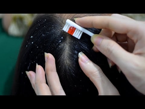 ASMR Relaxing Scalp Check / Lice Check / Dandruff Check Satisfying For Sleep