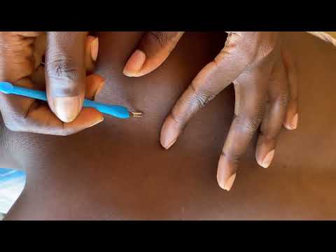 ASMR BACK SCRATCHING AND NITPICKING FOR SLEEP, RELAXING TRIGGERS