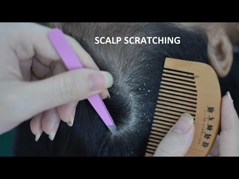 ASMR Scalp Check Real Person, Scalp Picking, Scalp Scratching With Tweezer Relaxing For Deep Sleep