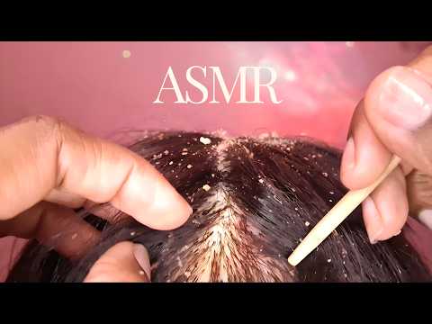 ASMR CASPA - Tirando Caspas do seu Cabelo🫧| lavando, esfregando e penteando (CASEIRO para DORMIR)