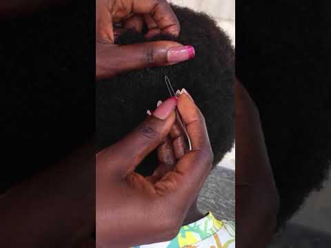 #scratching #scratch #satisfying #tingling #asmrscratching #skincare #nitpicking #tinglyfeeling