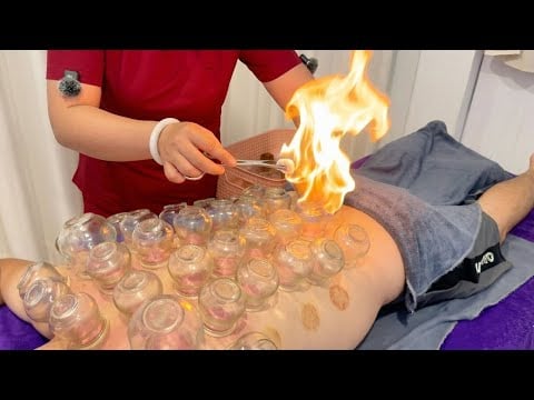 ASMR 🇻🇳 Legendary Co 8 Fire Cupping (Back & Stomach) in Ho Chi Minh City 🇻🇳 ($4) – So Intense 😳