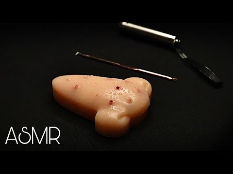 ASMR | Limpeza do nariz que está inflamado DURMA AQUI)