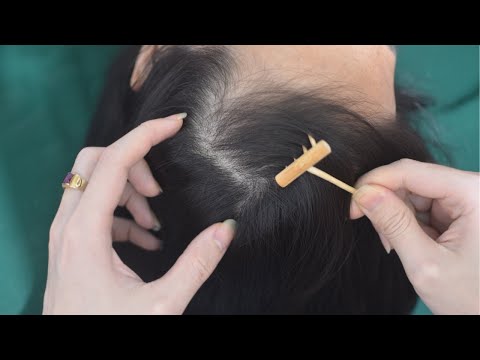 ASMR Real Person Hair Parting And Combing Sounds, Hair Tingly For Reduce Stress, Anxiety