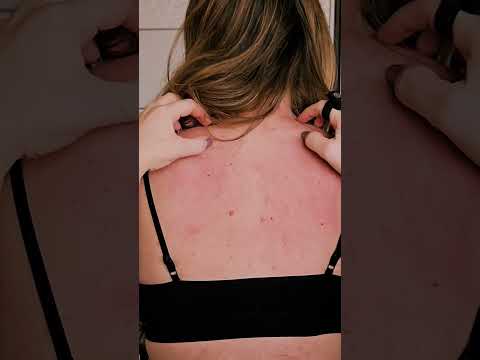 Gentle Back Scratching ASMR for Deep Relaxation #asmr #sleepasmr #relaxingasmr #asmrsounds #tingles