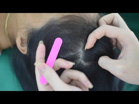 ASMR No Talking Hair Sounds ( Scalp Scratching, Scalp Massage, Hair Combing ) For Relaxation
