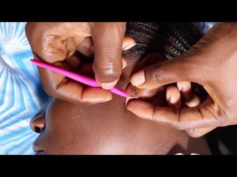 ASMR SUPER ATTENTIVE EAR PICKING AND CLEANING