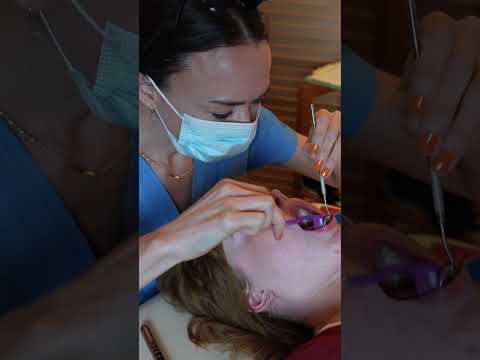 Asmr dental #asmr #asmrsounds #asmrvideo #relaxing #relax #satisfying #satisfyingvideo #tingles