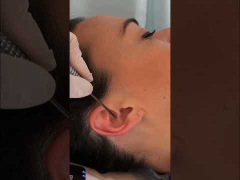 ASMR Ear Exam, Massage, Treatment 🩵 #asmr #asmrrealperson #asmrear #asmrmedical #asmrsounds
