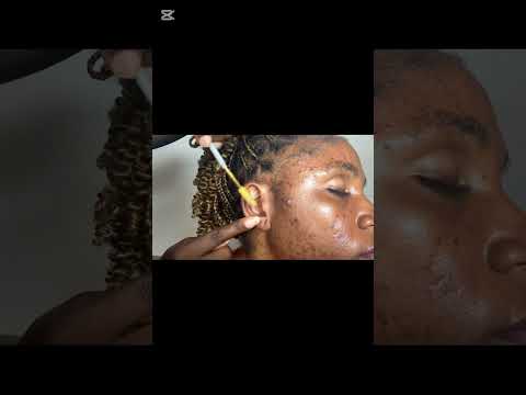 ASMR NECK MASSAGE, EAR CLEANING, SCALP SCRATCHING, ADAMS APPLE MASSAGE#asmrtapping